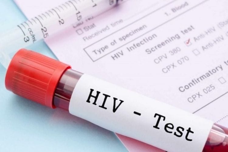 Điều kiện đối với cơ sở thực hiện xét nghiệm sàng lọc HIV